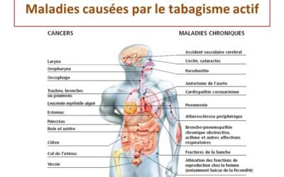 Je fume. Quels sont les risques ?